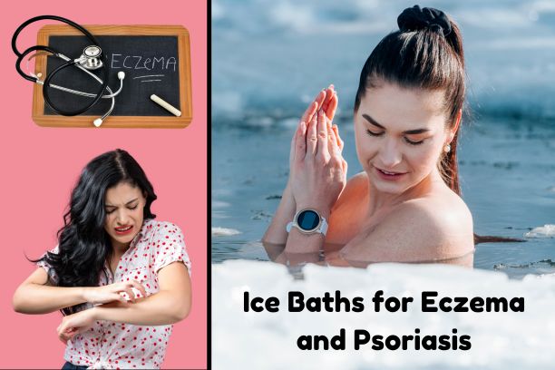 Ice Baths for Eczema & Psoriasis: Natural Itch Relief