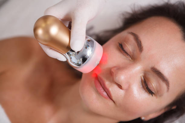 The Benefits of Red Light Therapy on Acne