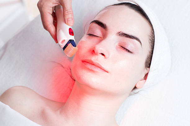 Red Light Therapy for Rosacea